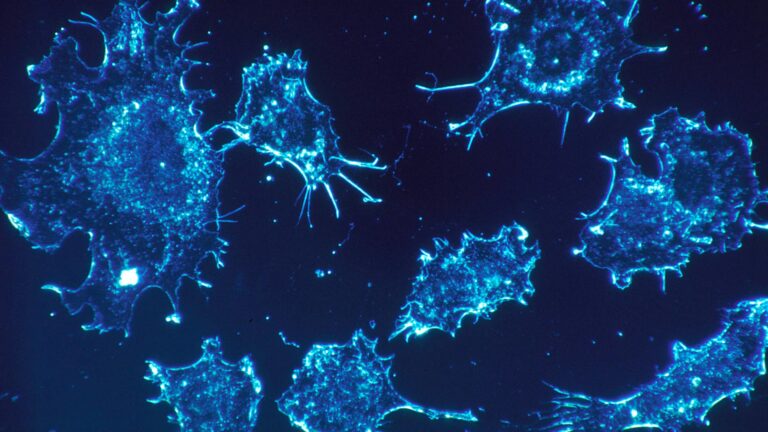 Research shows how cancer cells disable immune response in lymph nodes