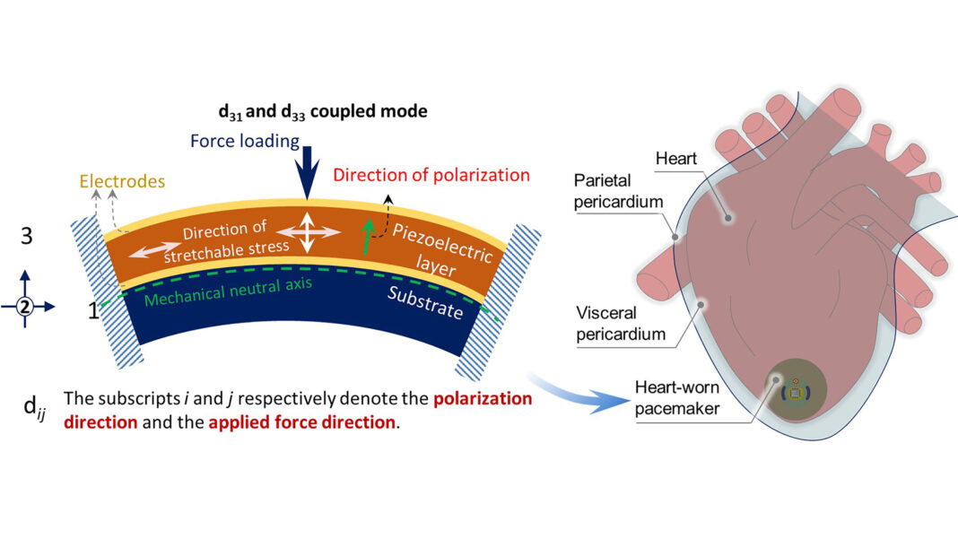 Researchers showcase concept of batteryless pacemaker powered by heart's energy