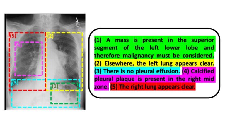 MIT researchers seek to use AI to speed diagnosis