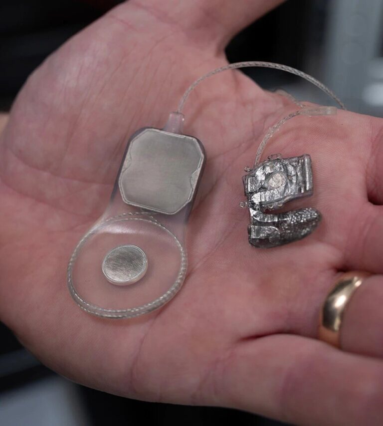 Encouraging bionic eye research could lead to human trials