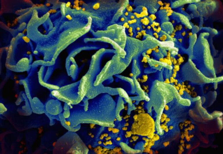 Woman appears to be cured of HIV after treatment with umbilical cord blood