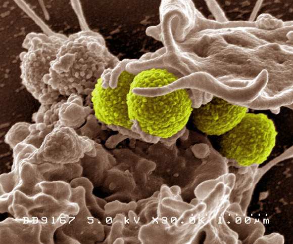 Liverpool scientists make advance in development of synthetic antibiotics targeting superbugs
