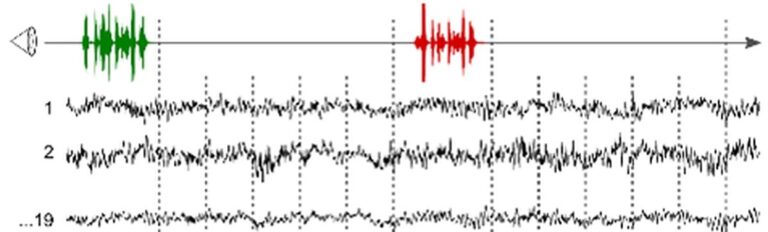 Hidden consciousness detected via EEG found to be predictor of recovery among unresponsive patients